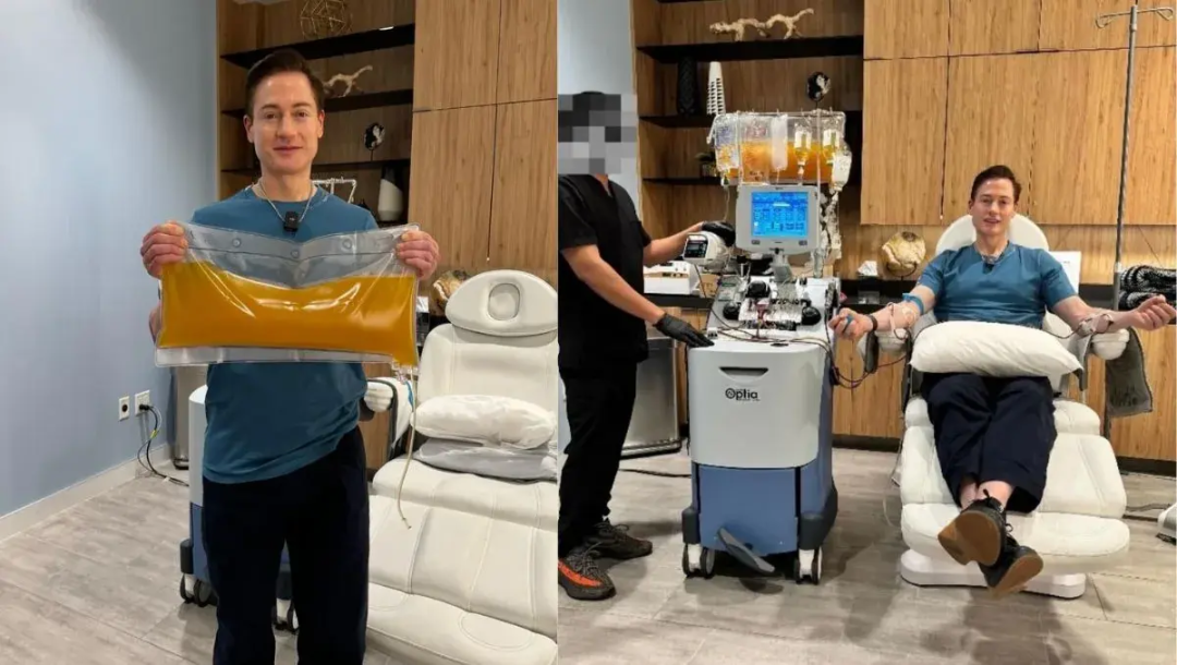 亿万富翁“换血哥”再次抽干自己“排毒”?继把儿子当血童、监测丁丁后,置换人造溶液追求“超洁净”?