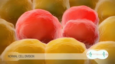 6种食物被证实「促癌」,很多人每天都在吃