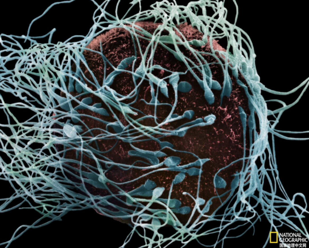 不孕不育女方占主因?研究表明:45岁以上男性精子的胚胎流产率会显著升高