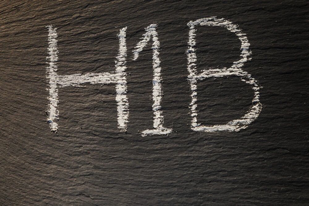 ��ת��H-1B 10����Ԫ����ѱ����Ժ��ͣ��