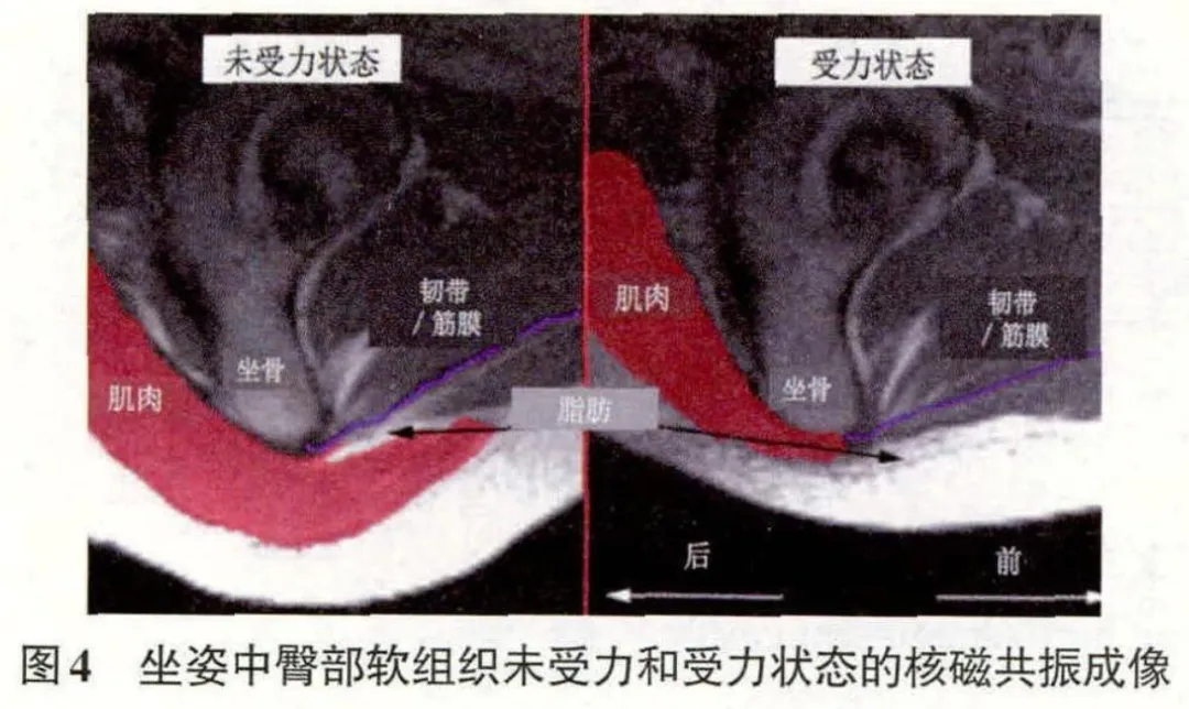 为什么有一个发达的屁股很重要!
