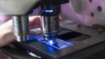 解读2014年诺贝尔化学奖：超清晰荧光显微成像 开启纳米微时代