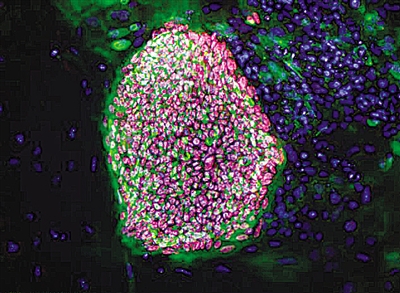 美首次用克隆技术以患者DNA制造胰岛素分泌细胞