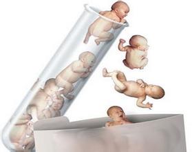 试管婴儿男多女少 是X染色体惹的祸？