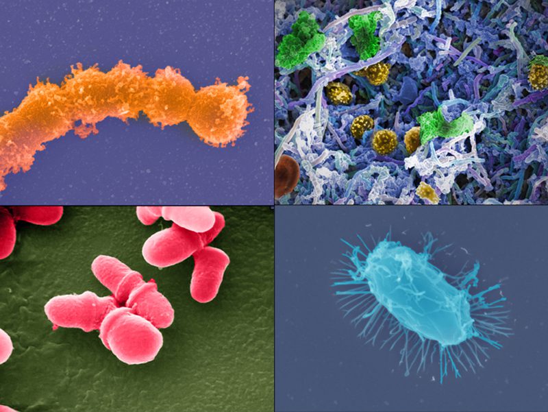 以总统之名，美国启动微生物研究新计划国家微生物组计划（NMI）