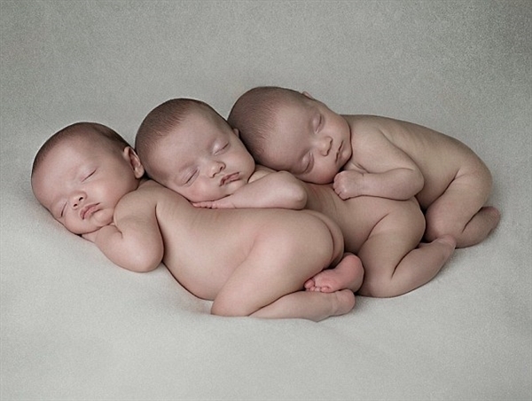 英国罕见三胞胎基因完全一致：两亿分之一概率