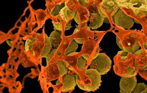 谢菲尔德大学和AGE英国大学利用Tetraspanins杀灭超级细菌MRSA