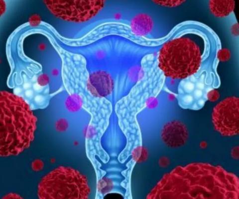 澳大利亚阿德莱德大学新验血方法可检测早期卵巢癌