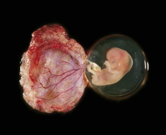 剑桥大学科学家团队：人类胎盘“类器官”可长期稳定培养