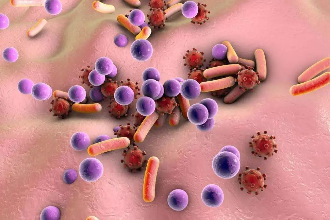 UCSD：人体表皮葡萄球菌的６―ＨＡＰ化合物 能抑制癌细胞增殖